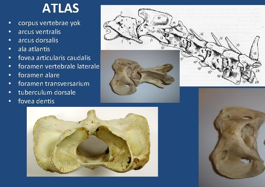 ATLAS • • • corpus vertebrae yok arcus ventralis arcus dorsalis ala atlantis fovea ATLAS • • • corpus vertebrae yok arcus ventralis arcus dorsalis ala atlantis fovea