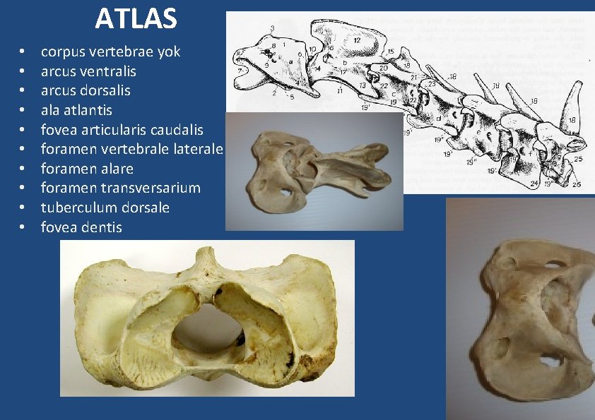 ATLAS • • • corpus vertebrae yok arcus ventralis arcus dorsalis ala atlantis fovea