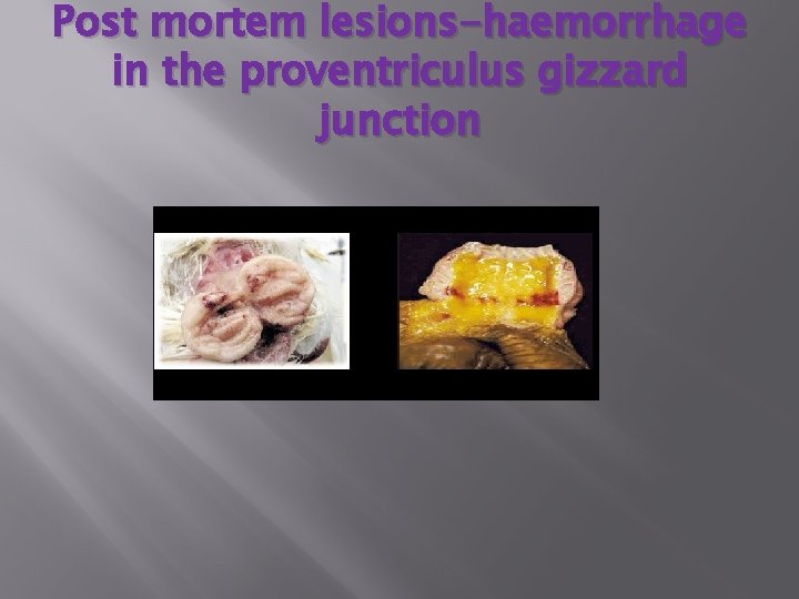 Post mortem lesions-haemorrhage in the proventriculus gizzard junction 