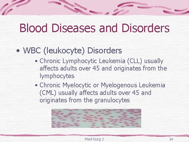 Blood Diseases and Disorders • WBC (leukocyte) Disorders • Chronic Lymphocytic Leukemia (CLL) usually