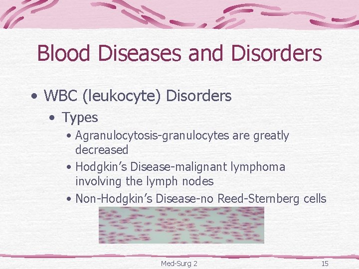 Blood Diseases and Disorders • WBC (leukocyte) Disorders • Types • Agranulocytosis-granulocytes are greatly