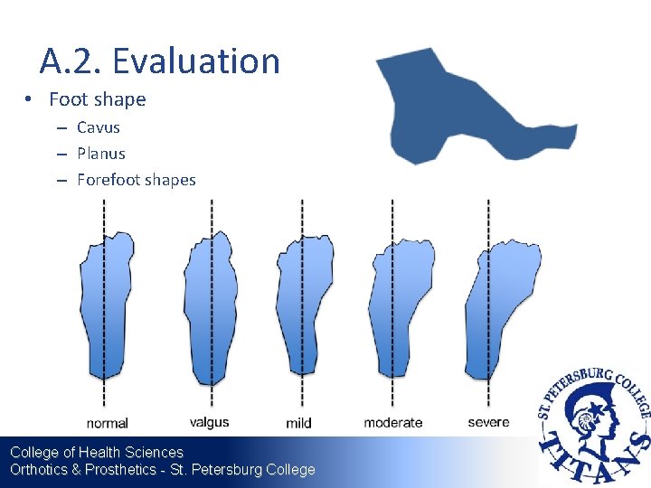 A. 2. Evaluation • Foot shape – Cavus – Planus – Forefoot shapes College