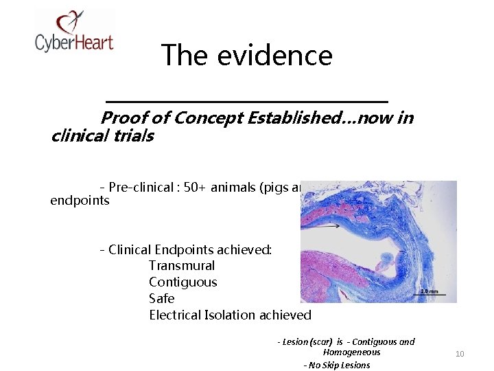 The evidence ____________ Proof of Concept Established…now in clinical trials - Pre-clinical : 50+