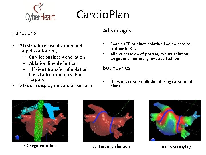 Cardio. Plan Functions • • 3 D structure visualization and target contouring – Cardiac