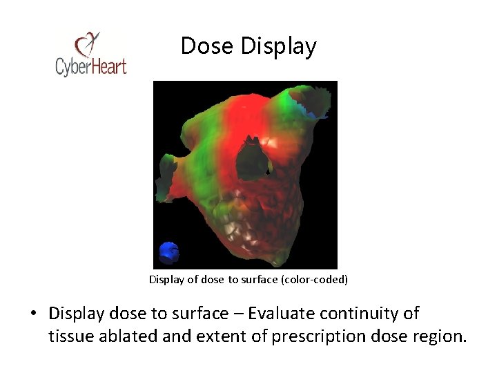 Dose Display of dose to surface (color-coded) • Display dose to surface – Evaluate