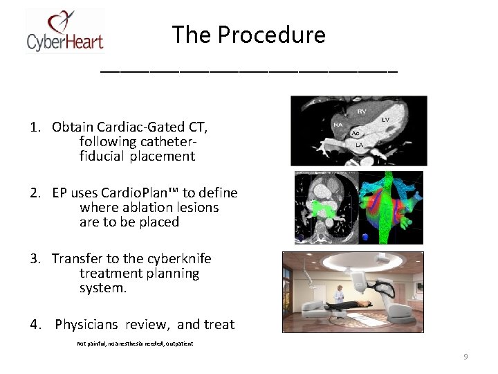 The Procedure _______________ 1. Obtain Cardiac-Gated CT, following catheterfiducial placement 2. EP uses Cardio.