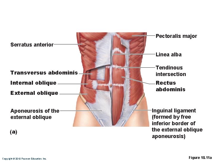 Pectoralis major Serratus anterior Linea alba Transversus abdominis Internal oblique External oblique Aponeurosis of