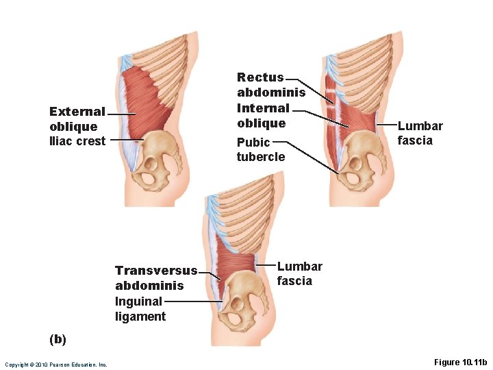 Rectus abdominis Internal oblique External oblique IIiac crest Pubic tubercle Transversus abdominis Inguinal ligament