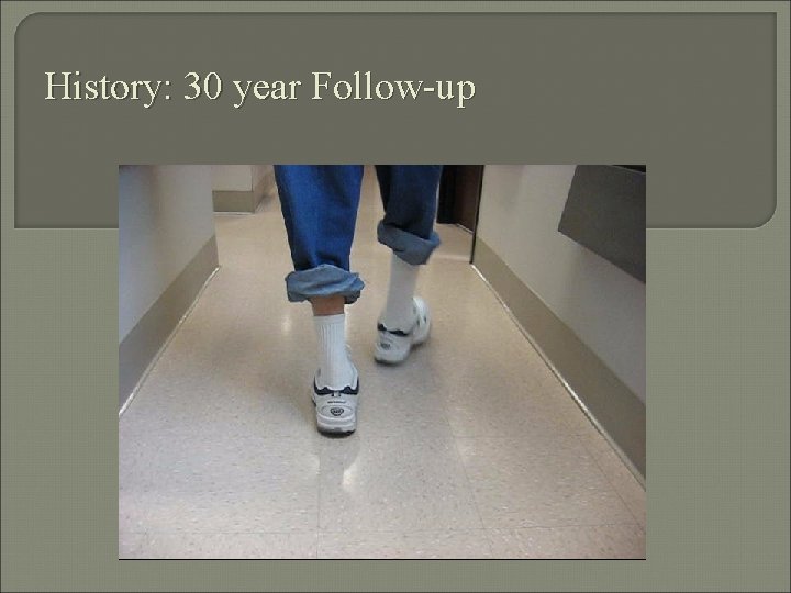 History: 30 year Follow-up 