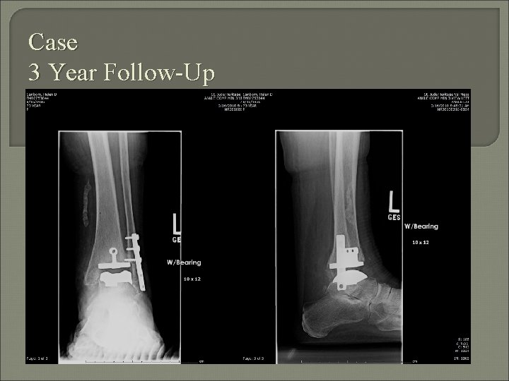 Case 3 Year Follow-Up 