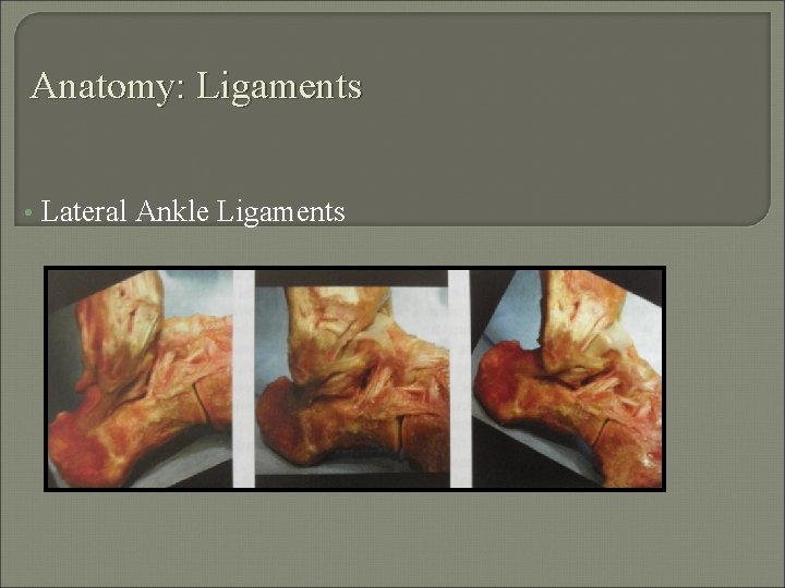 Anatomy: Ligaments • Lateral Ankle Ligaments 