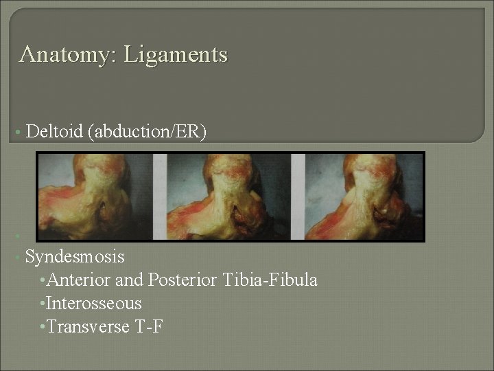 Anatomy: Ligaments • Deltoid (abduction/ER) • • Syndesmosis • Anterior and Posterior Tibia-Fibula •