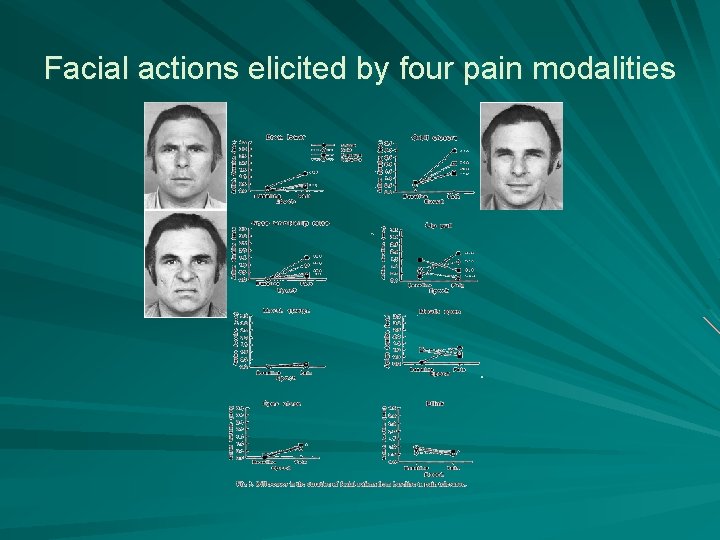 Facial actions elicited by four pain modalities 
