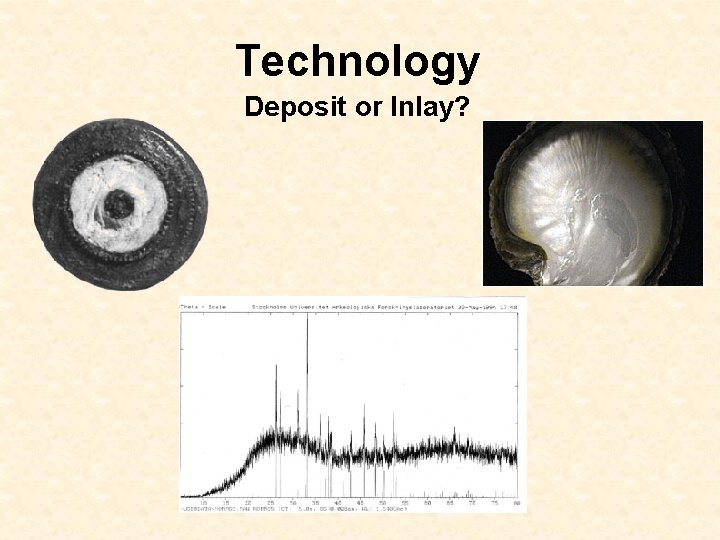 Technology Deposit or Inlay? 