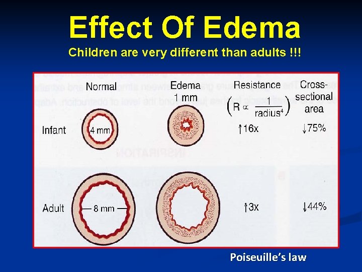Effect Of Edema Children are very different than adults !!! Poiseuille’s law 