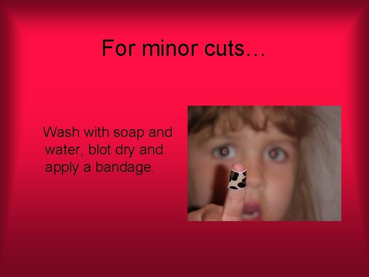 For minor cuts… Wash with soap and water, blot dry and apply a bandage.