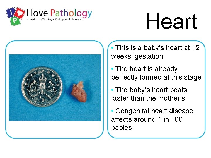 Heart • This is a baby’s heart at 12 weeks’ gestation • The heart
