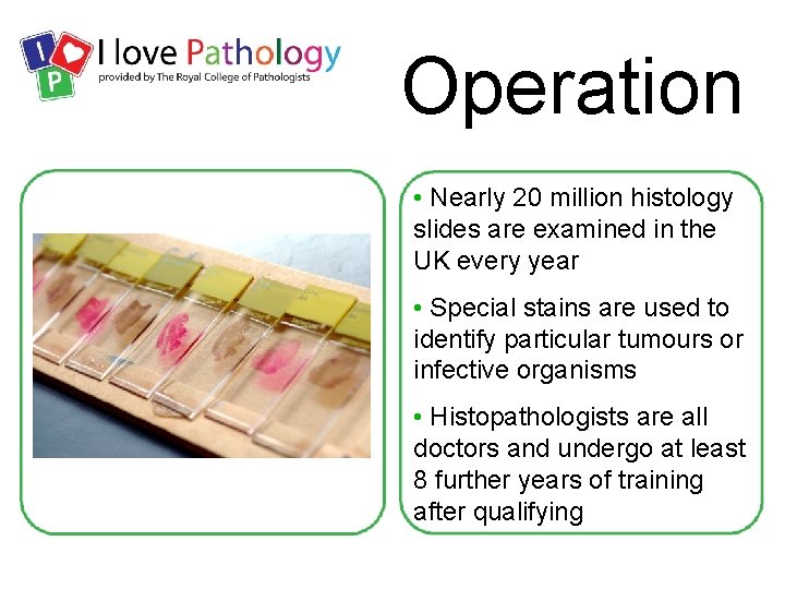 Operation • Nearly 20 million histology slides are examined in the UK every year