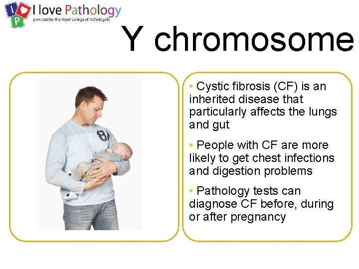 Y chromosome • Cystic fibrosis (CF) is an inherited disease that particularly affects the