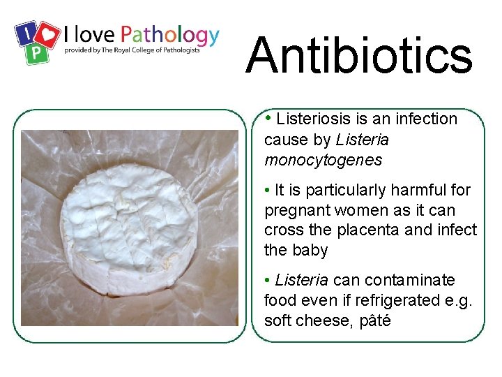 Antibiotics • Listeriosis is an infection cause by Listeria monocytogenes • It is particularly