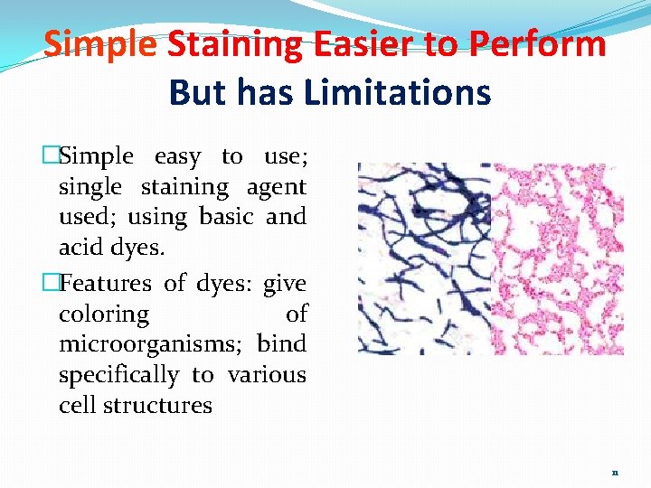 Simple Staining Easier to Perform But has Limitations �Simple easy to use; single staining