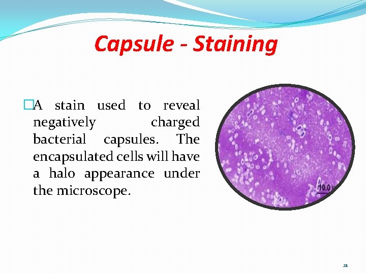 Capsule - Staining �A stain used to reveal negatively charged bacterial capsules. The encapsulated