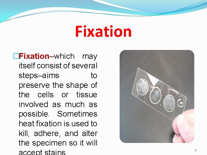 Fixation �Fixation–which may itself consist of several steps–aims to preserve the shape of the