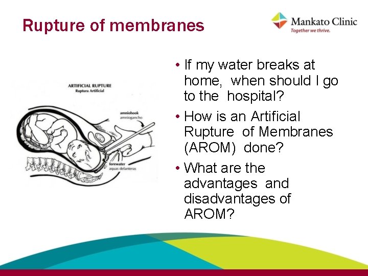 Rupture of membranes • If my water breaks at home, when should I go