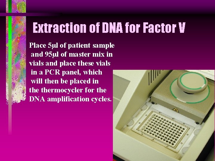 Extraction of DNA for Factor V Place 5µl of patient sample and 95µl of