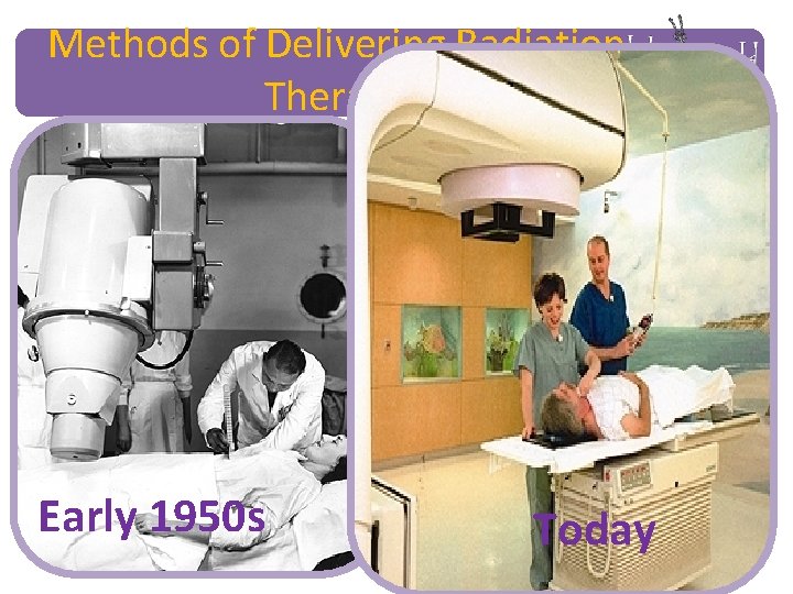 Methods of Delivering Radiation Therapy Early 1950 s Today 