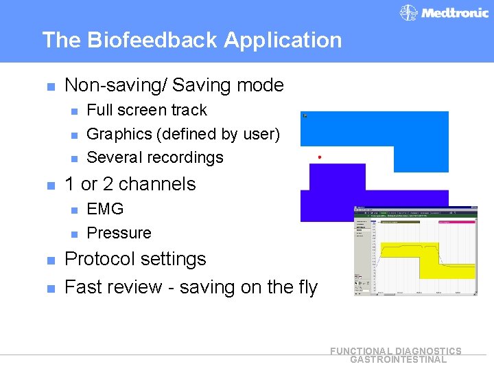 The Biofeedback Application n Non-saving/ Saving mode n n 1 or 2 channels n