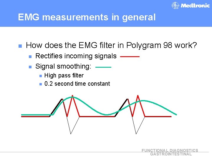 EMG measurements in general n How does the EMG filter in Polygram 98 work?