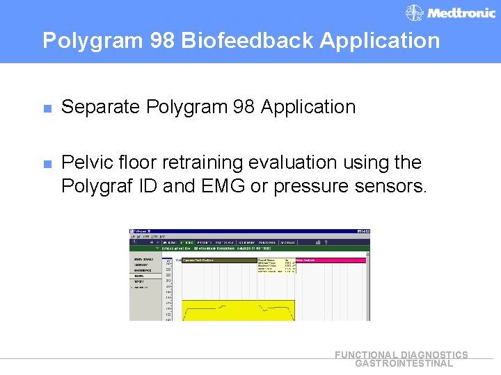 Polygram 98 Biofeedback Application n Separate Polygram 98 Application n Pelvic floor retraining evaluation