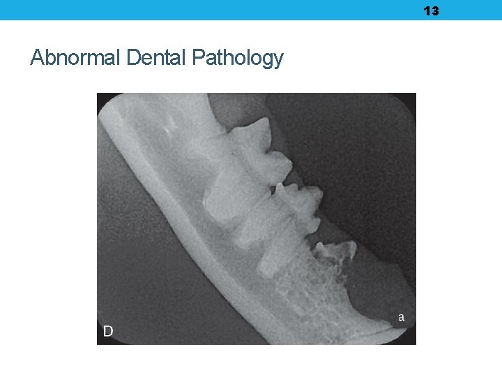 13 Abnormal Dental Pathology 