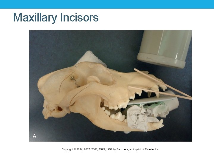 Maxillary Incisors 