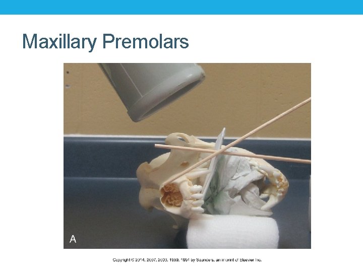 Maxillary Premolars 