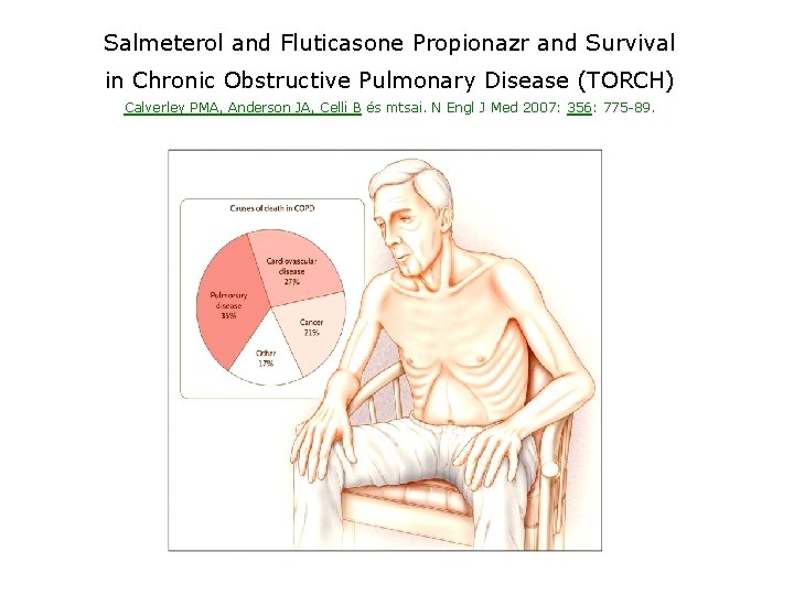 Salmeterol and Fluticasone Propionazr and Survival in Chronic Obstructive Pulmonary Disease (TORCH) Calverley PMA,