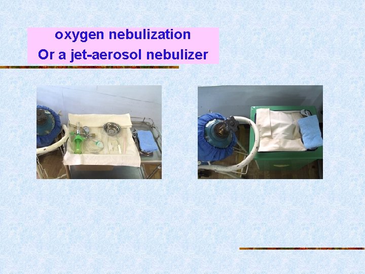 oxygen nebulization Or a jet-aerosol nebulizer 