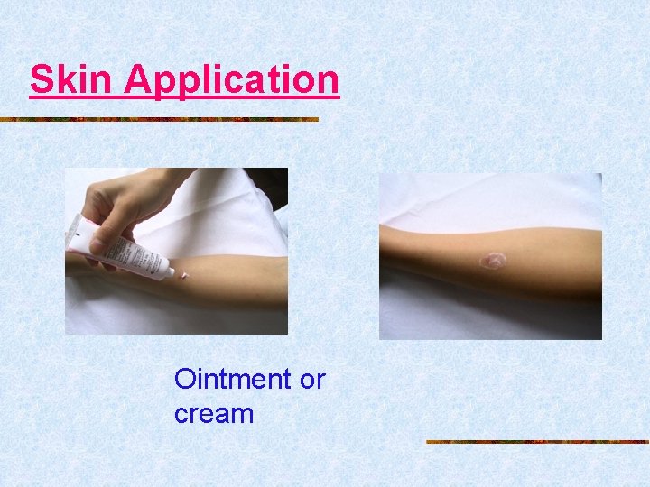 Skin Application Ointment or cream 