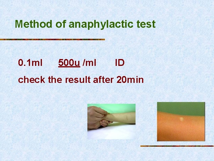 Method of anaphylactic test 0. 1 ml 500 u /ml ID check the result