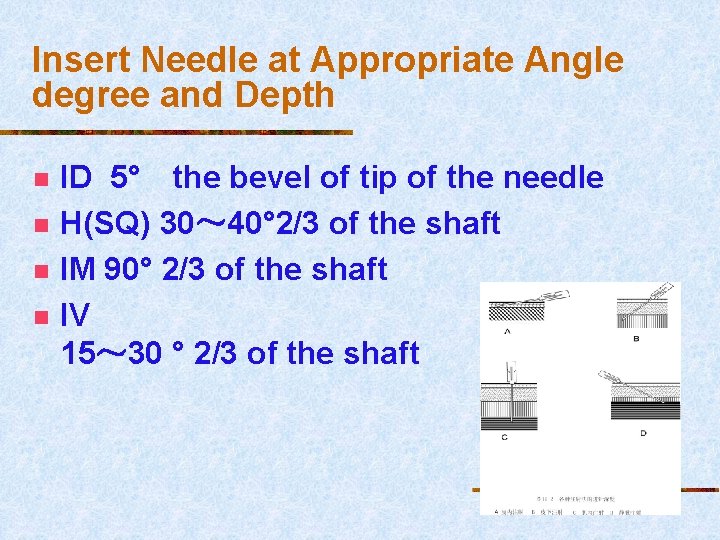 Insert Needle at Appropriate Angle degree and Depth n n ID 5° the bevel