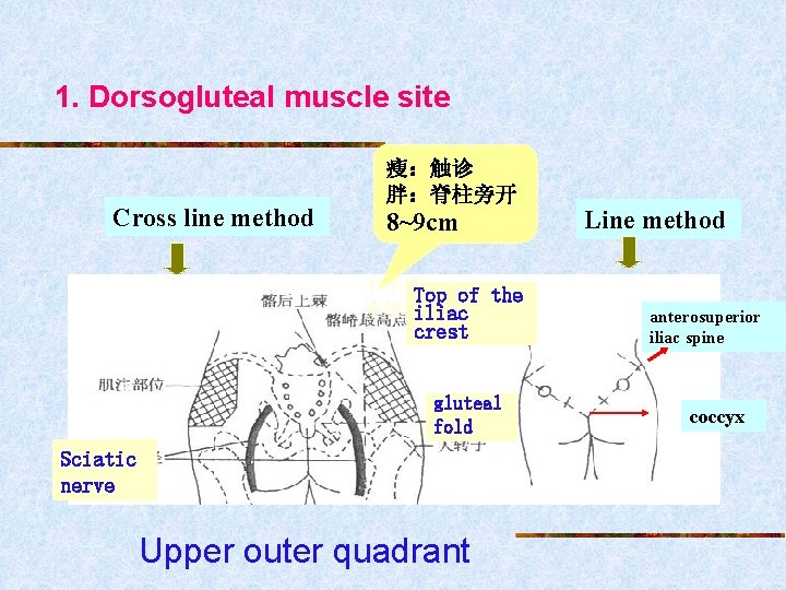 1. Dorsogluteal muscle site Cross line method 瘦：触诊 胖：脊柱旁开 8~9 cm 十字法 Top of
