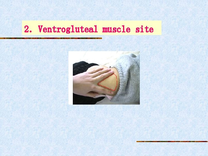 2．Ventrogluteal muscle site 