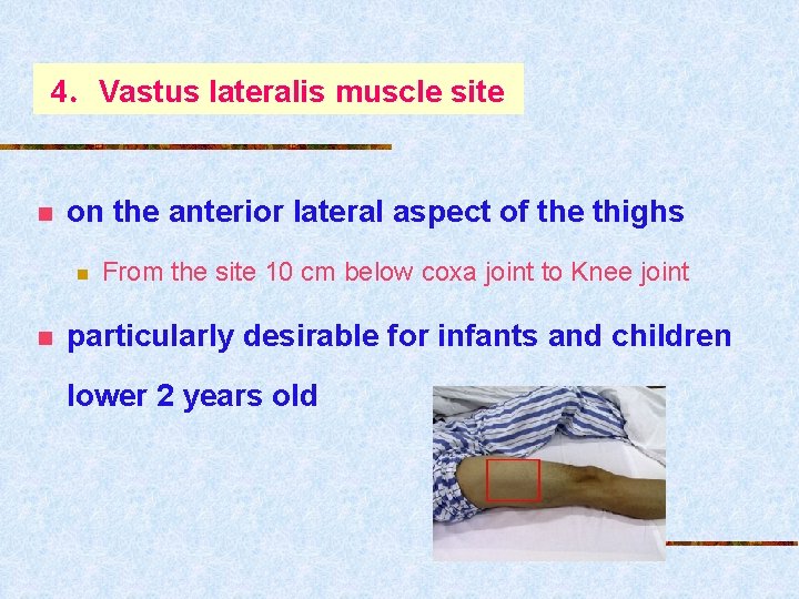 4．Vastus lateralis muscle site n on the anterior lateral aspect of the thighs n