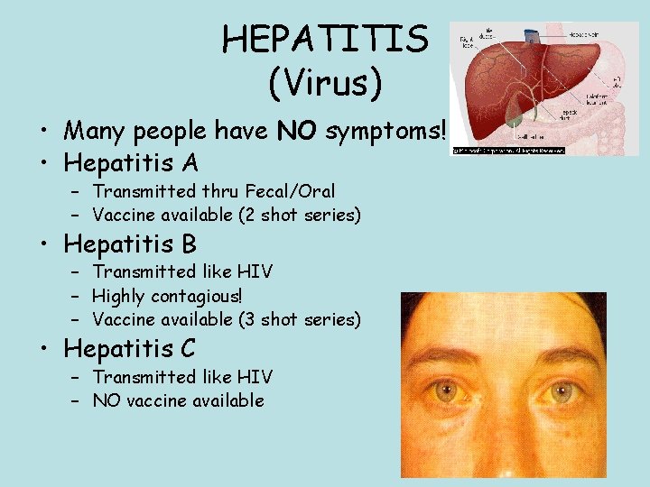 HEPATITIS (Virus) • Many people have NO symptoms! • Hepatitis A – Transmitted thru