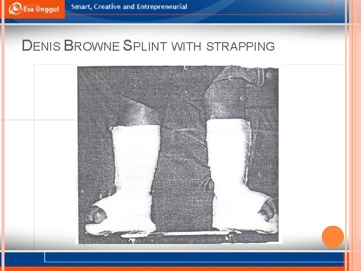 DENIS BROWNE SPLINT WITH STRAPPING 