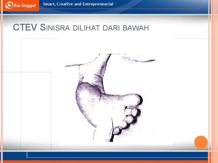 CTEV SINISRA DILIHAT DARI BAWAH 