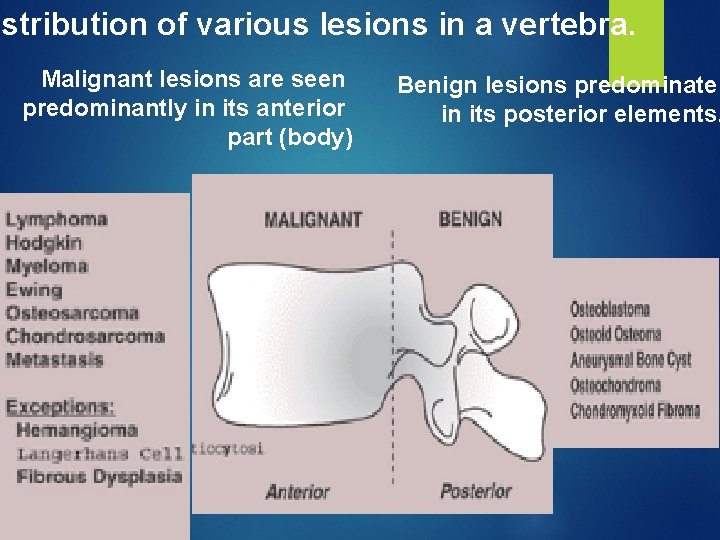 istribution of various lesions in a vertebra. Malignant lesions are seen predominantly in its