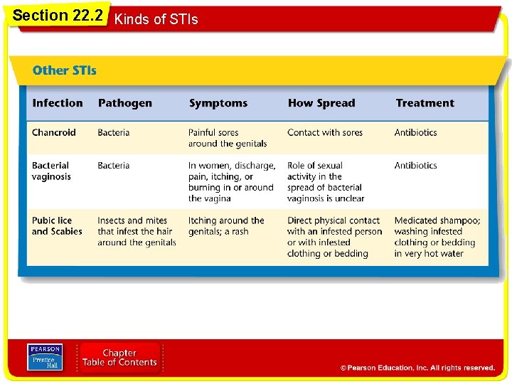 Section 22. 2 Kinds of STIs 