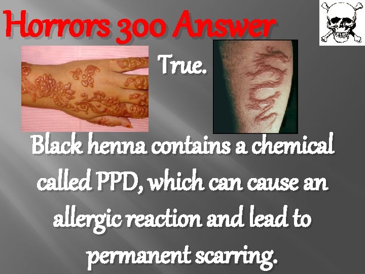 Horrors 300 Answer True. Black henna contains a chemical called PPD, which can cause